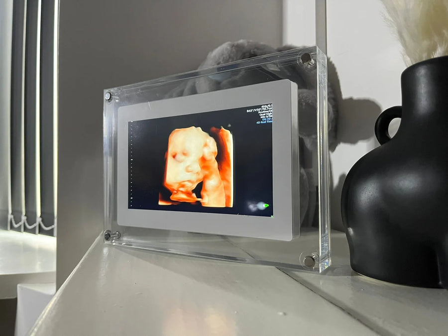 Eco Baby Live Frame