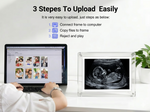 Eco Baby Live Frame™ | Marco Digital para Bebés 8